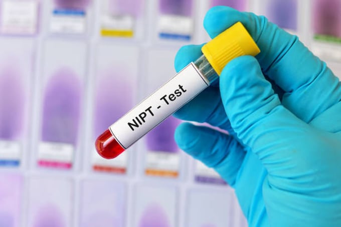 xét nghiệm NIPT