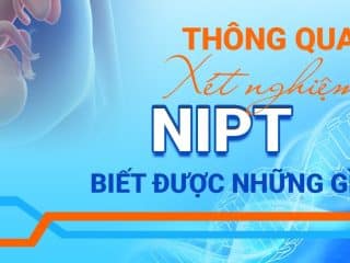 Xét nghiệm NIPT biết được những gì