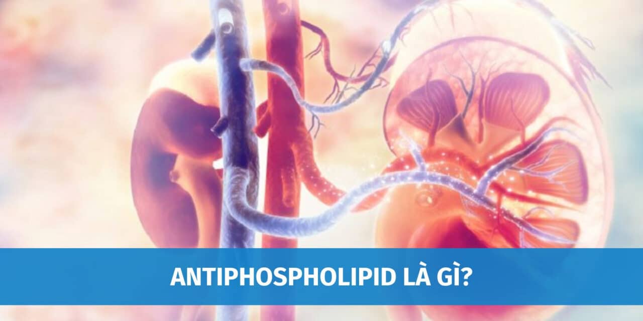 Antiphospholipid Là Gì? Nguyên Nhân Và Triệu Chứng Của Hội Chứng Antiphospholipid
