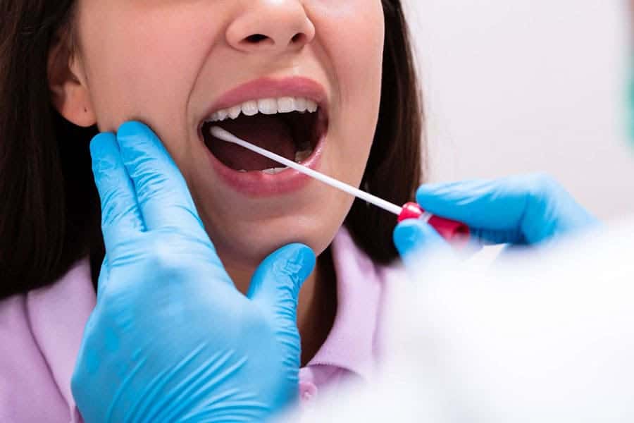 xét nghiệm ADN bằng niêm mạc miệng